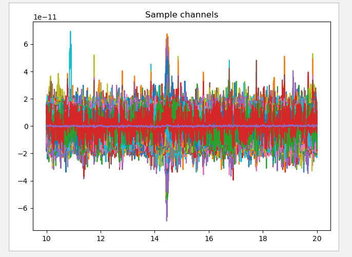 BCI--Python-EEG Tool Library MNE